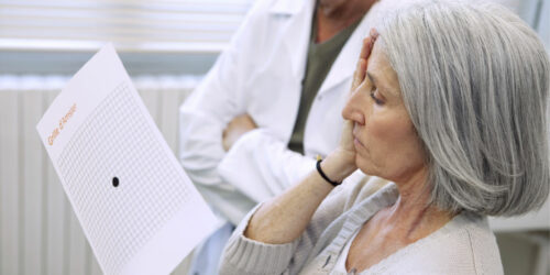 All About Age-related Macular Degeneration