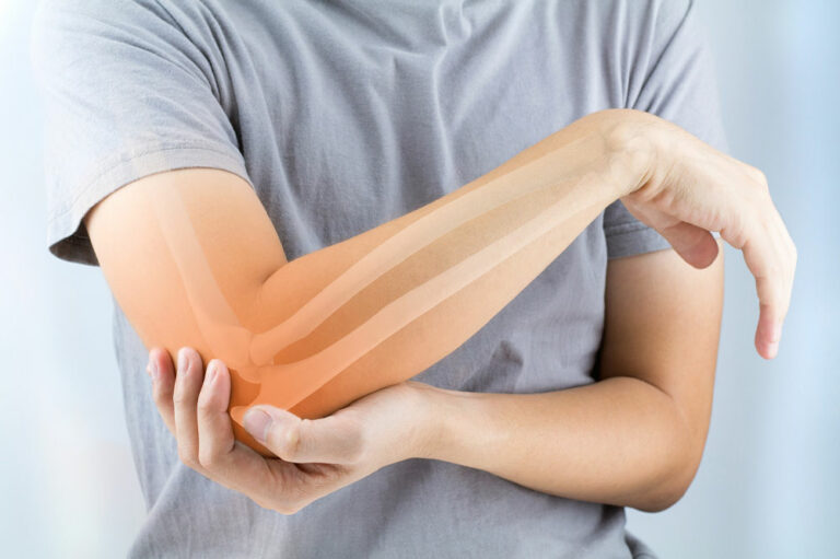 5 Health Conditions That May Trigger Osteoporosis and Bone Loss